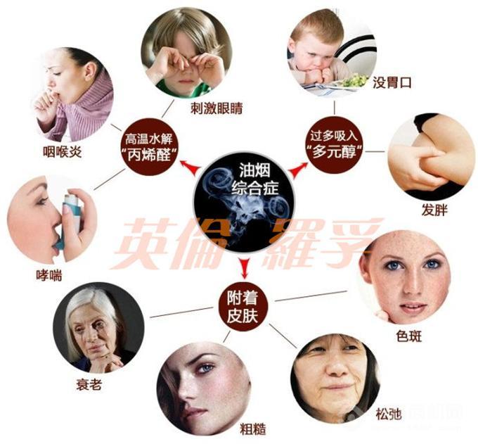 英倫羅孚 英倫羅孚