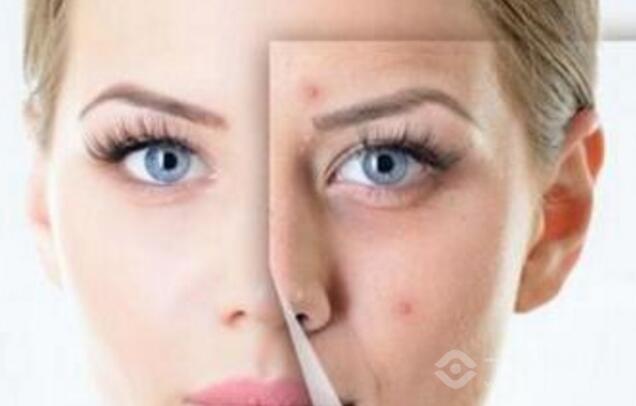 渼颜堂祛斑祛痘