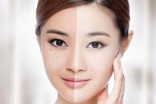 渼颜堂祛斑祛痘 渼颜堂祛斑祛痘