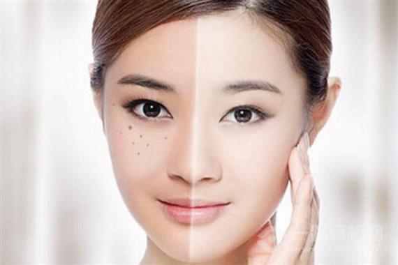 渼颜堂祛斑祛痘