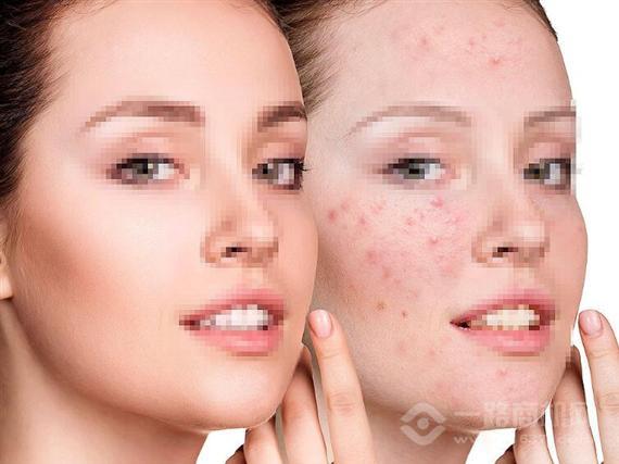 西施三绝祛斑美容中心