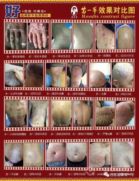 苗一手清肤老铺