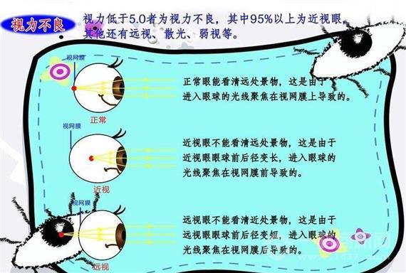 微净界视力恢复
