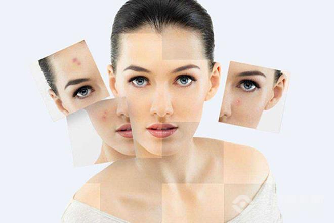 焕颜芳专业祛痘加盟