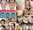 玫颜堂祛斑祛痘