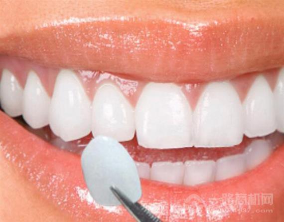 铂尔汀牙齿美容