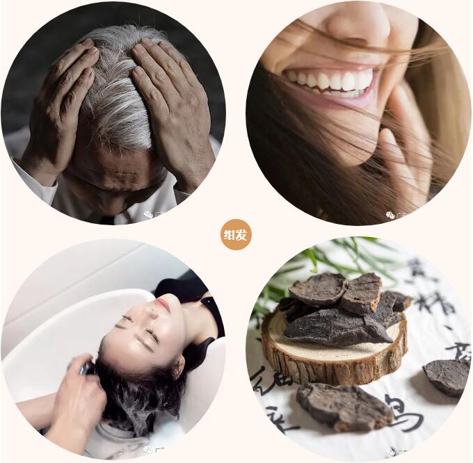 白发一族 白发一族