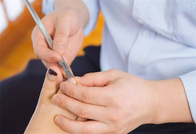 历名修脚 历名修脚