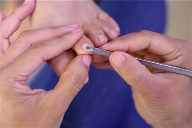 陕西专业修脚店加盟 陕西专业修脚店加盟