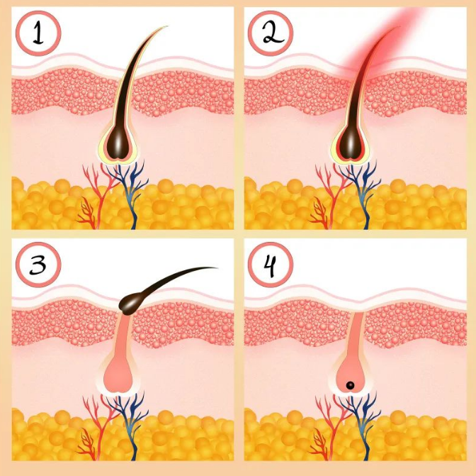 圣鼎堂养发馆加盟
