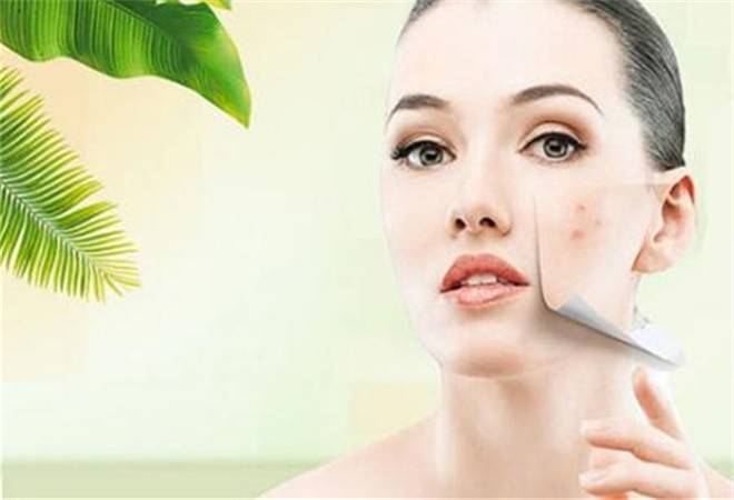 皇莎医美祛痘祛斑