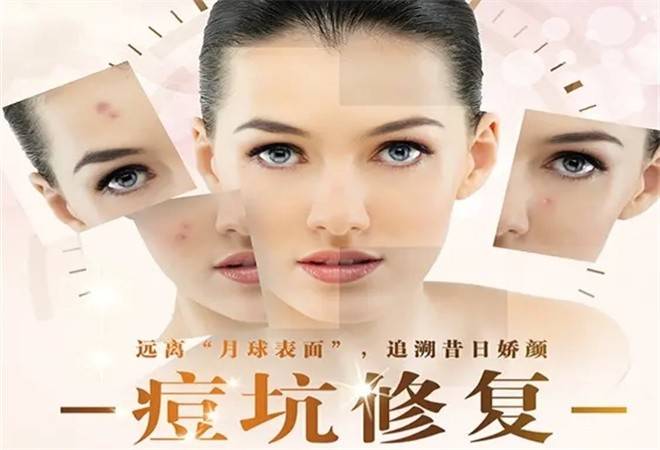 素颜佳人祛斑祛痘