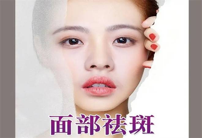 素颜佳人祛斑祛痘