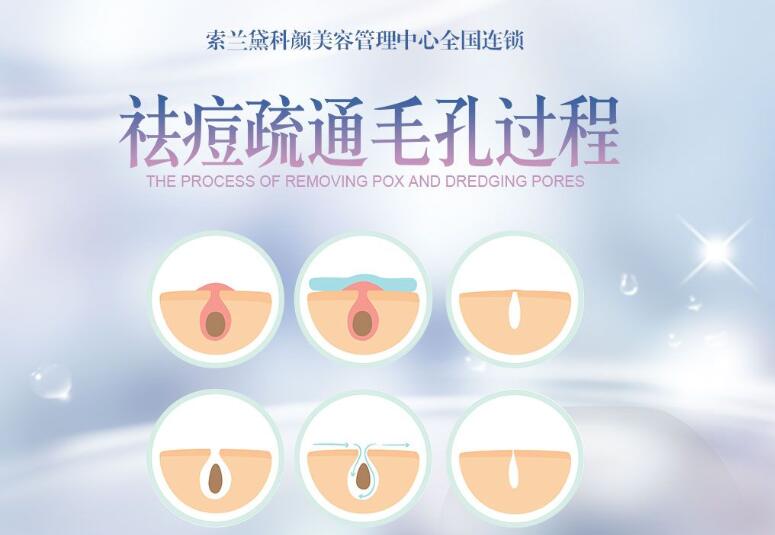 索蘭黛美容加盟