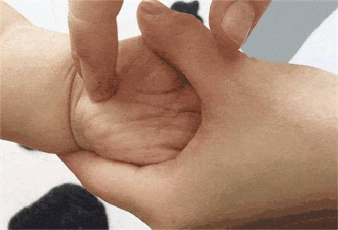 安儿到家小儿推拿