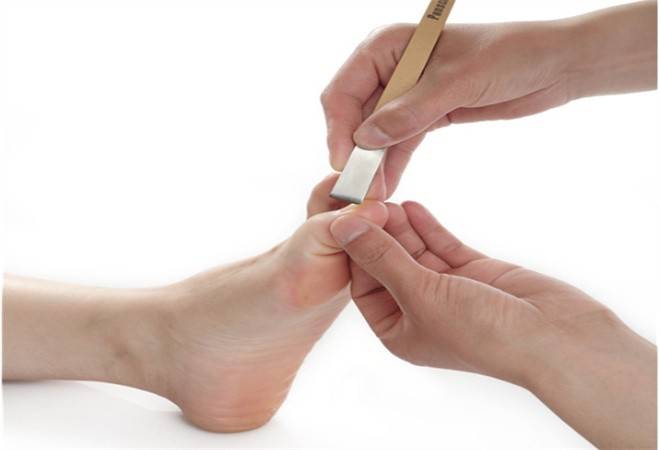 甲舒乐灰指甲足疗修脚