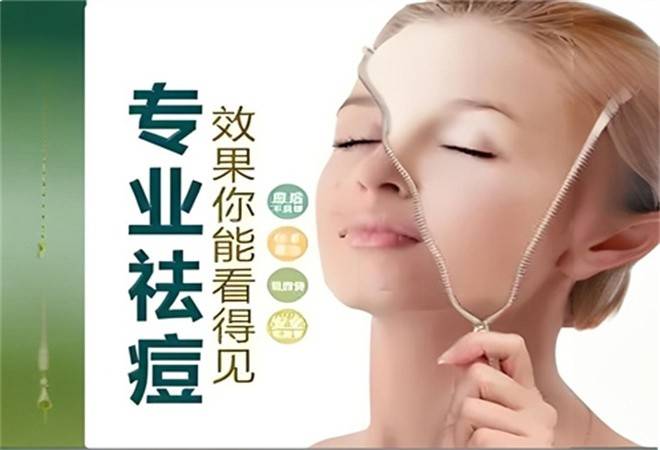 尊瑞专业祛斑祛痘