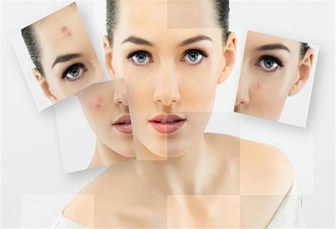 尊瑞专业祛斑祛痘