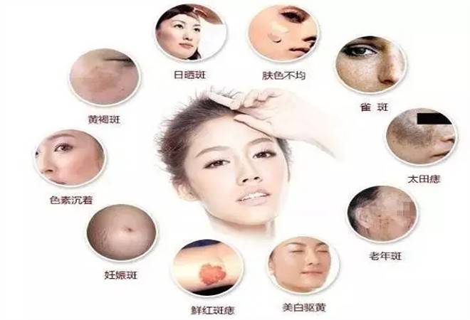 肤碧然专业祛斑