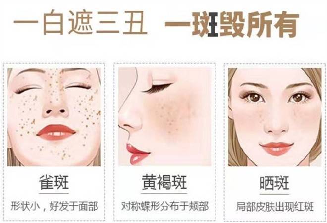 肤碧然专业祛斑