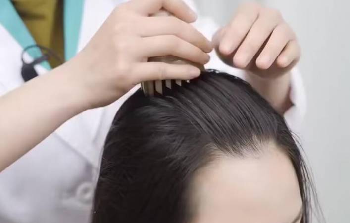 头倍爽瑶方特色头疗