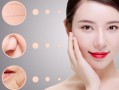 曼容颜袪斑祛痘