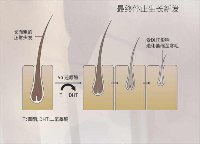 波斯坦植物养发