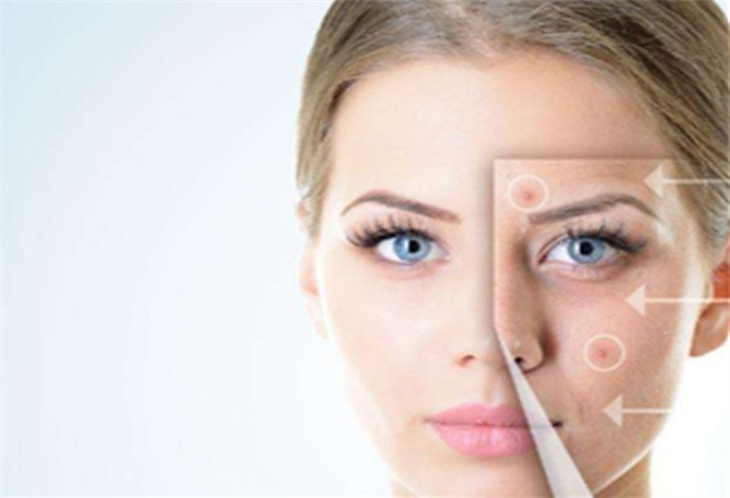 鑫妍國際祛斑祛痘