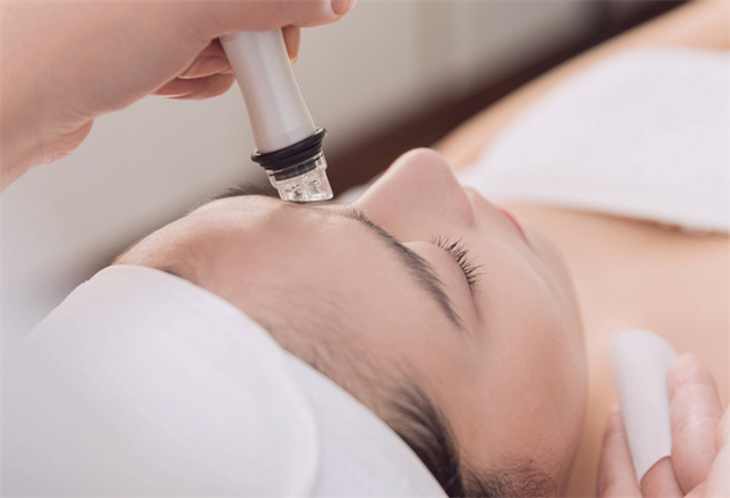 诺琦格祛斑加盟 诺琦格祛斑加盟