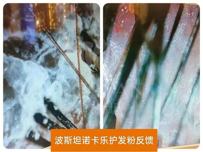 波斯坦植物养发