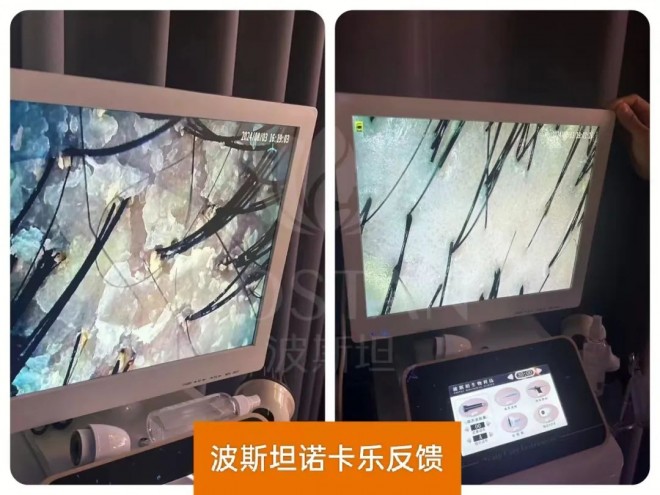 波斯坦植物养发