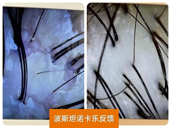 波斯坦植物养发