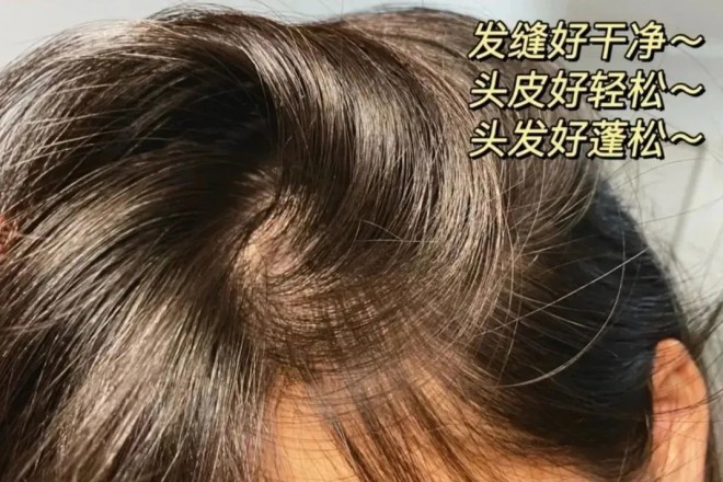 波斯坦植物养发