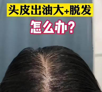 波斯坦植物养发 波斯坦植物养发