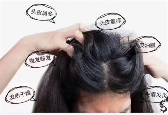 博芳園生發養發加盟