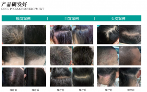 黑奧秘脫發(fā)白發(fā)中心