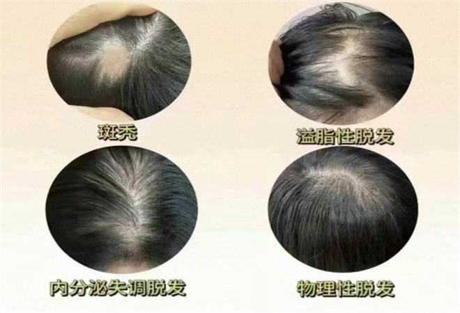 烏悅養(yǎng)發(fā)