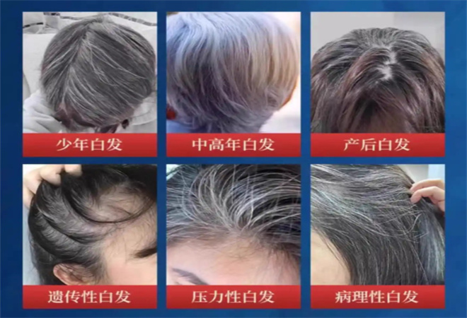 烏悅養(yǎng)發(fā)加盟