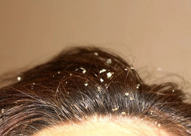 波斯坦植物養(yǎng)發(fā)加盟